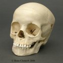 5yrold skull.jpg