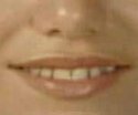 MMANicholaou teeth.jpg