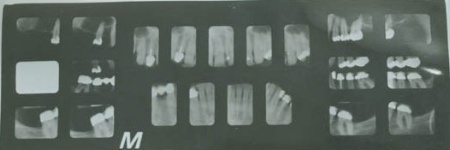 198umsc_dentals.jpg