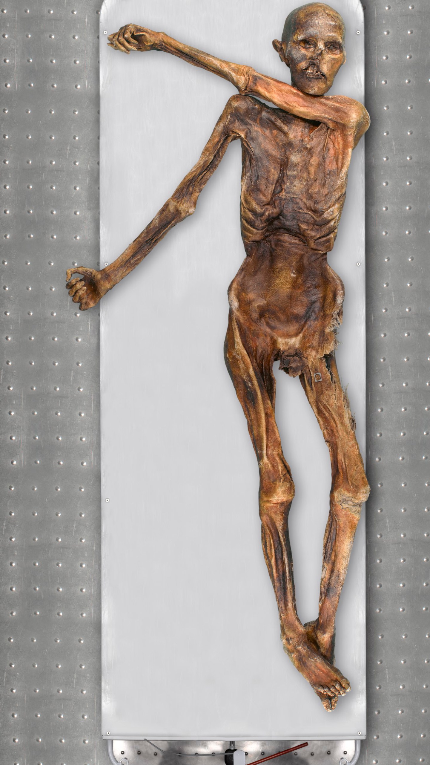 This photo provided by The South Tyrol Museum of Archaeology shows Oetzi the Iceman, one of the oldest human glacier mummies. Decades after he was discovered in the Italian Alps, scientists determined that Oetzi was mostly descended from farmers from present day Turkey, and his head was balder and skin darker than what was initially thought, according to a study published Wednesday, Aug. 16, 2023, in the journal Cell Genomics. (Marco Samadelli, Gregor Staschitz/South Tyrol Museum of Archaeology/EURAC via AP)