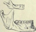 Fig-71-Lower-jaw-of-child-and-adult-showing-the-mental.jpg