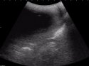 new zoo baby ultrasound copy_1515642183242.jpg_75743103_ver1.0_640_480.jpg