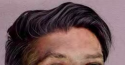Harmless Hairline.png