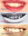97UFWA Teeth - D Munyon and K Lee Comparison.jpg