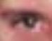 DDawson Eye2.JPG