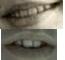 CM Dentures b.jpg