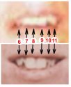 Kay Docherty and Olive Branch JD Teeth Comparison.jpg