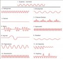 abnormal-breathing-patterns.jpg