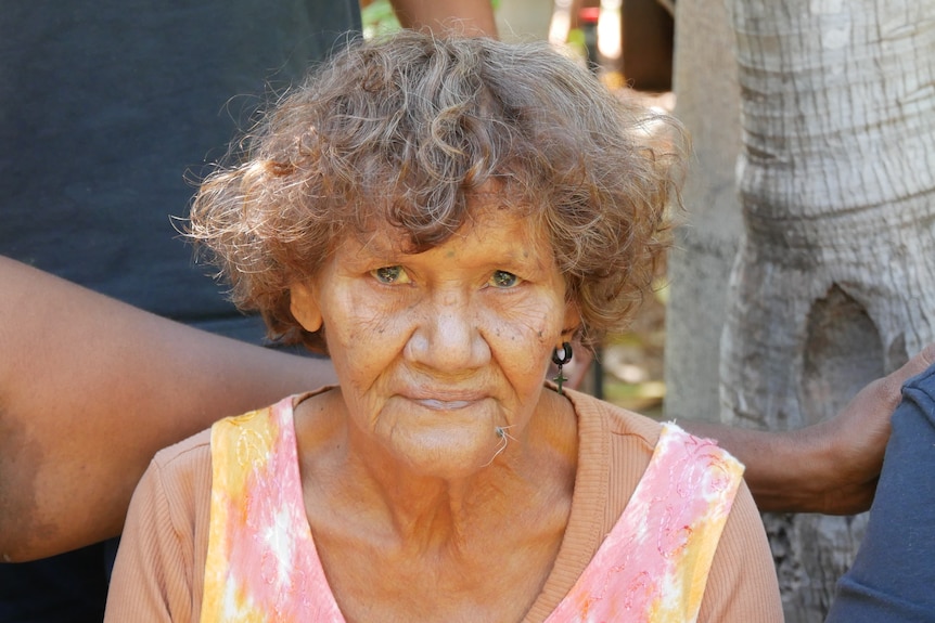 Woman with short brown curly hair stares at camera.