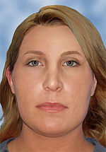 150px-Detroit_Jane_Doe_facial_reconstruction.jpg